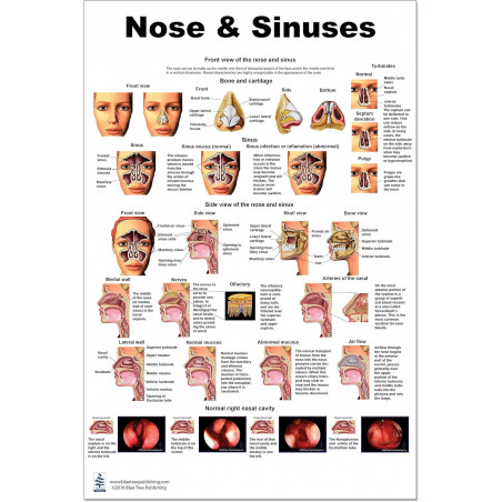 Nose and Sinus Large Poster