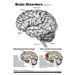Brain Disorders Anatomical Chart front