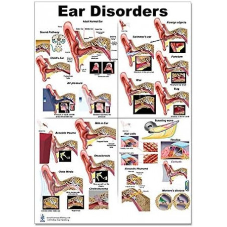 Ear Disorders Regular Poster