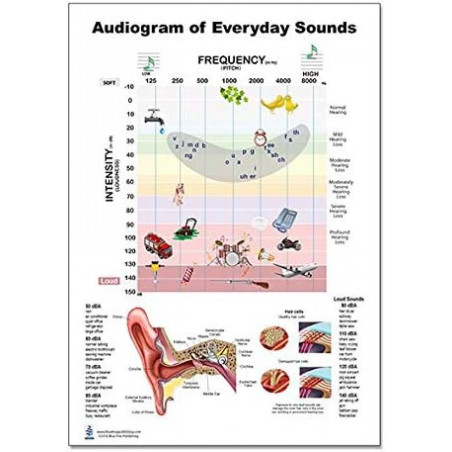 Audiogram of Everyday Sound Regular Poster, Speech Banana, Frequency, Pitch and Ear Information