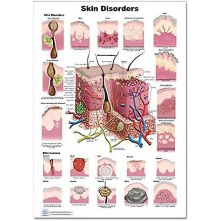 Skin Disorders Regular Poster