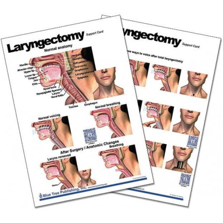 Laryngectomy Anatomical Chart