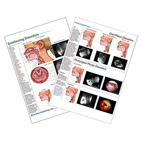 Swallowing Disorders Anatomical Chart