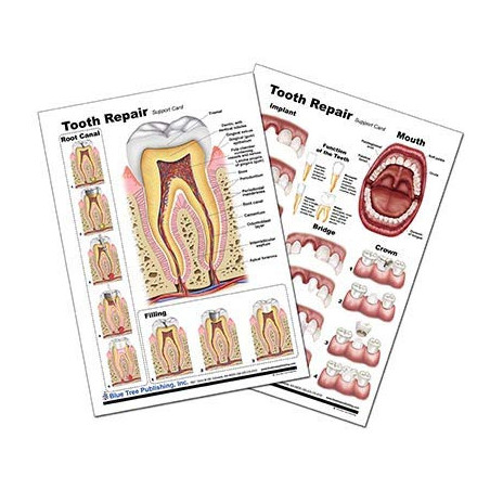 Tooth Repair Anatomical Chart