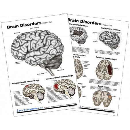Brain Disorders Anatomical Chart