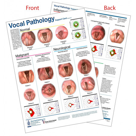 Vocal Pathology 1 Chart, Malignant, Neurological, Inflammation, Benign