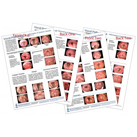 Vocal Pathology 4 Chart Set, Inflammatory, Systemic Disease