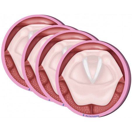 Vocal Folds Sticky Notes 4 Pack