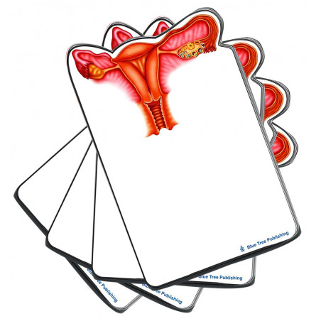Uterus Sticky Notes 4 Pack