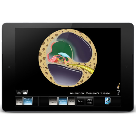 Inner Ear Disorders App