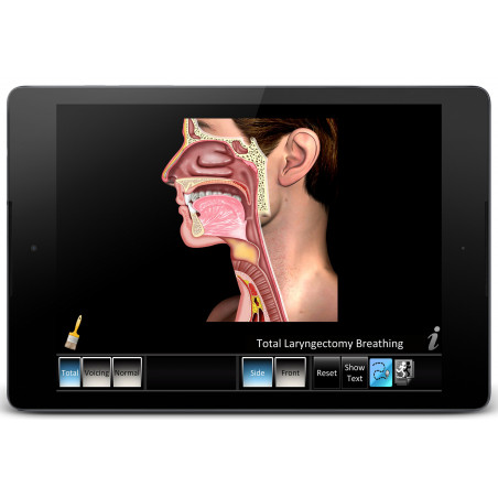 Laryngectomy App