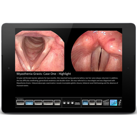 Vocal Pathology: Neurological App