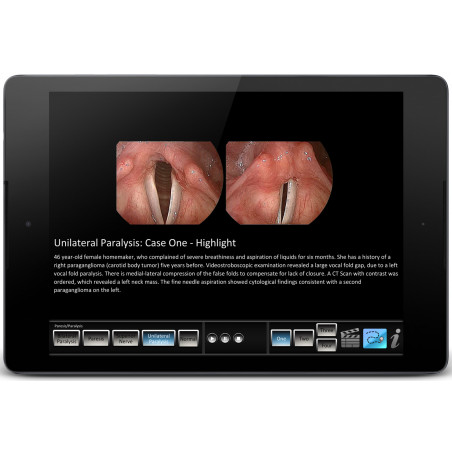 Vocal Pathology: Paresis/Paralysis App
