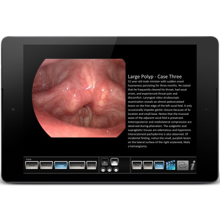 Vocal Pathology: Polyps App