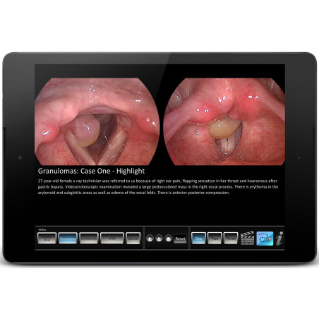 Vocal Pathology: Relux