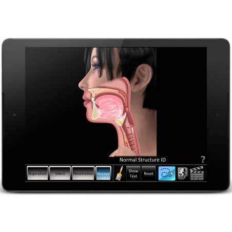 Swallowing Aspiration App