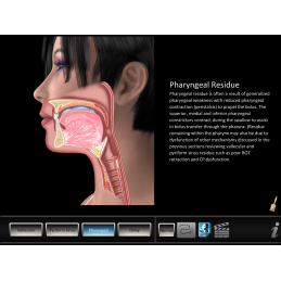 Swallowing Residue App