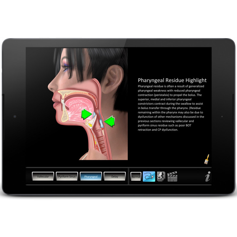 Swallowing Residue App
