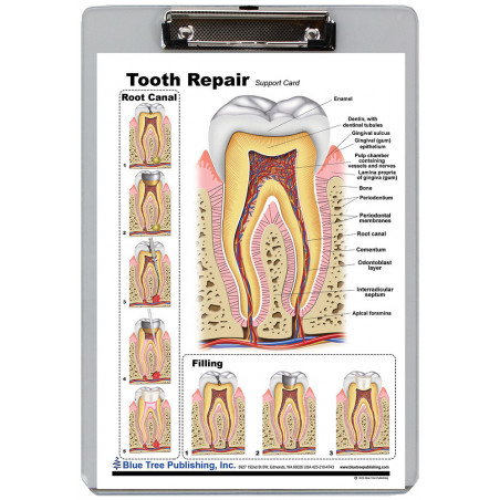 Tooth Repair Clipboard