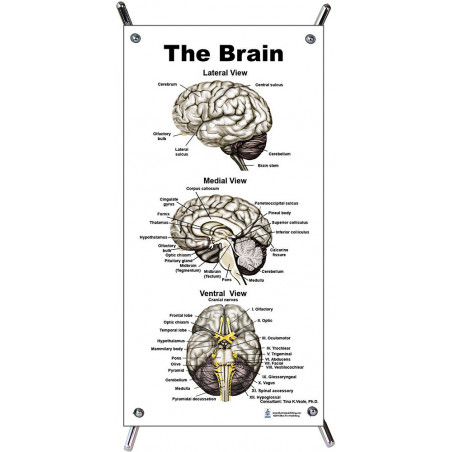 Brain Exterior Small Poster