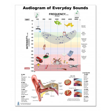 Audiogram Medium Poster