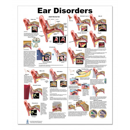 Ear Disorders Medium Poster