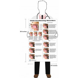 Child Swallowing Disorders Large Poster Dysphagia Endoscopic View-oral Phase Disorders-nasal Regurgitation