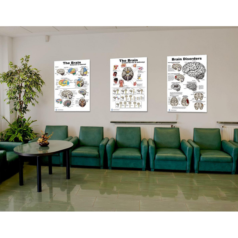 Brain, Cranial Nerves, Pathways and Brain Disorders 3 Poster set 24 ...