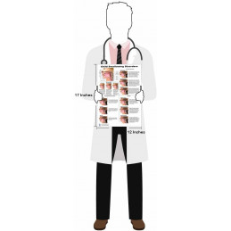 Child Swallowing Disorders Chart, 12x17inch, Dysphagia Endoscopic View-oral Phase Disorders-nasal Regurgitation