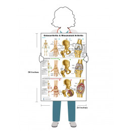 Osteoarthritis & Rheumatoid Arthritis, Large Poster 24x36