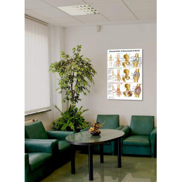 Osteoarthritis & Rheumatoid Arthritis, Large Poster 24x36