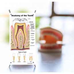 Tooth Anatomy, Decay, Oral Cavity 3 set Small Poster