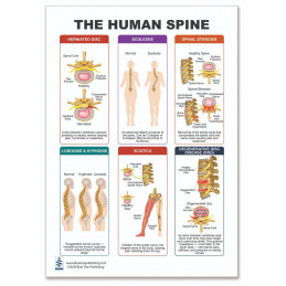 Spine Health Clipboard — A4 Clipboard with Removable Double-Sided Chart | Blue Tree Publishing