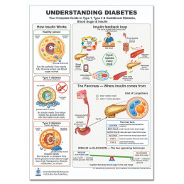Understanding Diabetes — Laminated Double-Sided A4 Reference Card | Blue Tree Publishing