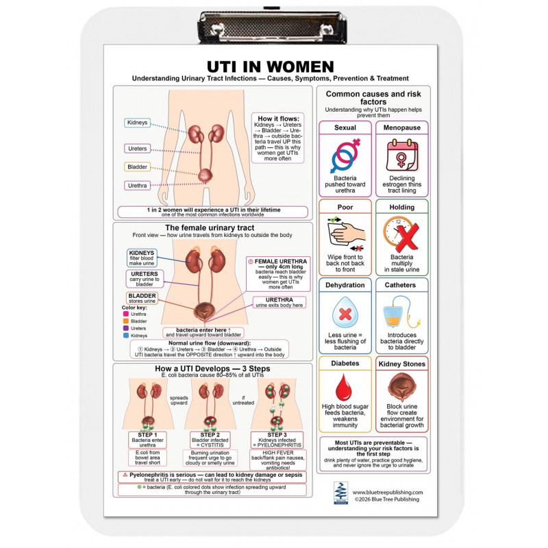 UTI in Women Clipboard — Durable A4 Clipboard with Removable Double-Sided Chart