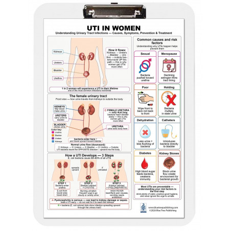 UTI in Women Clipboard — Durable A4 Clipboard with Removable Double-Sided Chart