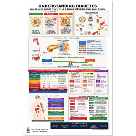 Understanding Diabetes Poster | Type 1, Type 2 & Gestational Chart