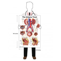 Urinary Tract Poster Set – UTI in Women & Men + Anatomy Chart (3-Pack)
