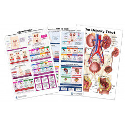 Urinary Tract Poster Set – UTI in Women & Men + Anatomy Chart (3-Pack)