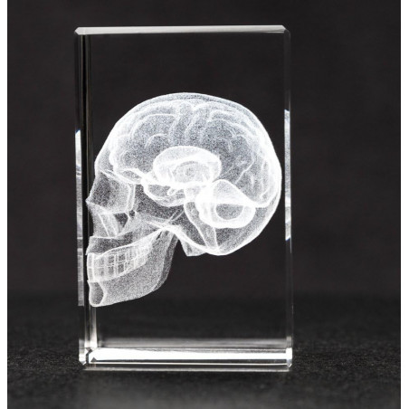 Skull and Brain 3D Laser Medium Size Crystal
