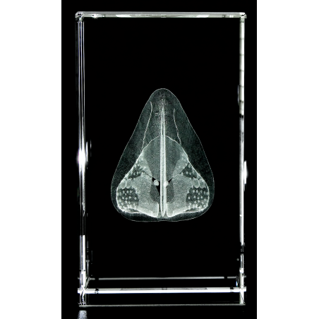 Nose 3D Laser Medium Crystal, Anatomy, Rhinology