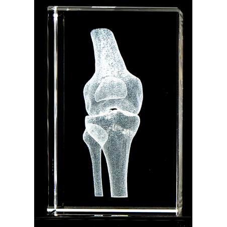 Knee Joint 3d Laser Large Crystal