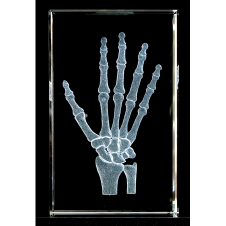 Hand and Wrist 3D Laser Large Crystal with Skeleton Sticky Note, Anatomy, Bone, Physical Therapy Sports