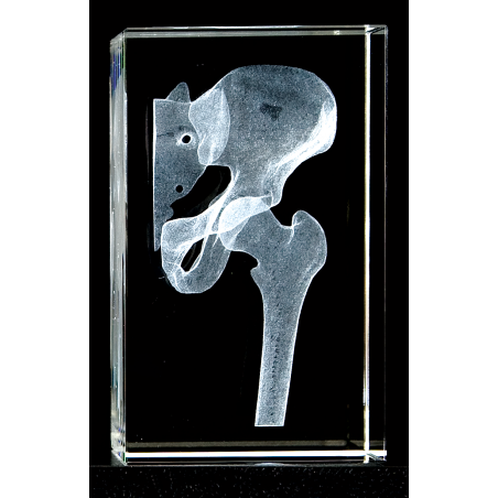 Hip Joint 3d Laser Large Crystal Anatomy, Bone, Physical Therapy, Sports