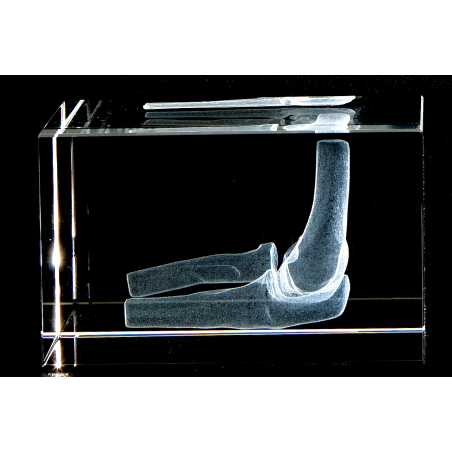 Elbow Joint 3D Laser Large Crystal, Anatomy, Bone, Physical Therapy, Sports, Tennis