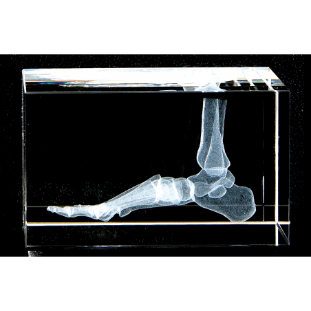 Foot and Ankle 3d Laser Large Crystal, Anatomy, Bone, Physical Therapy, Sports